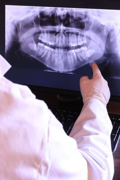 Best Root Canal Emergency Dentist  in Woodway, TX