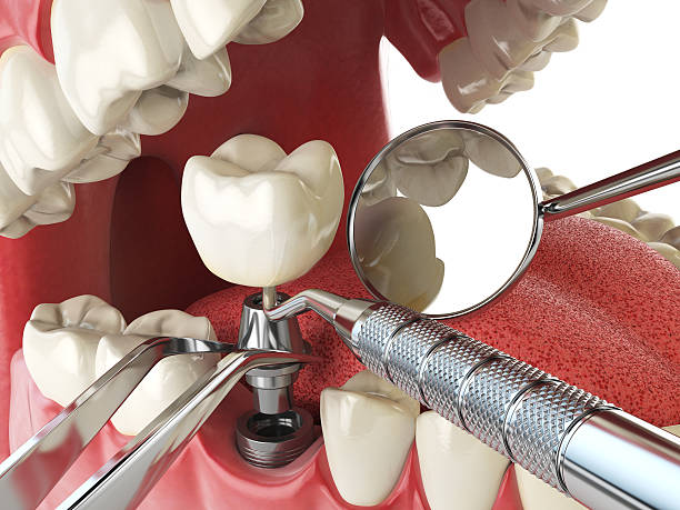 Best Cracked Tooth Emergency Dentist  in Woodway, TX